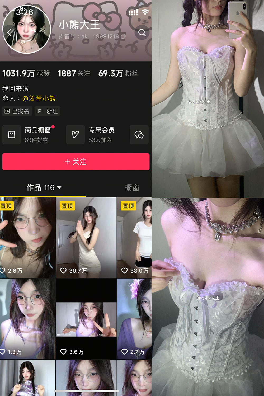 抖音 小熊大王 微密圈 001期 【32P】-私密小圈