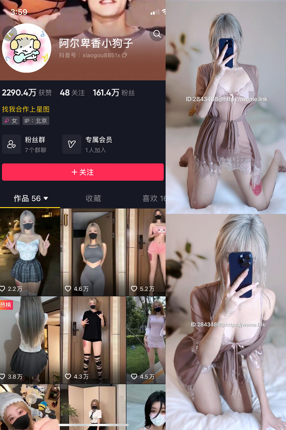 抖音 阿尔卑香小狗子 微密圈  NO.045期 【39P】最新至：2026.6.9-私密小圈